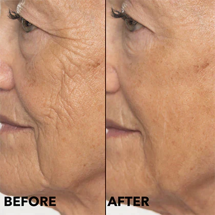 Double Retinol & Collagen Peptide Serum Treatment - Image 3