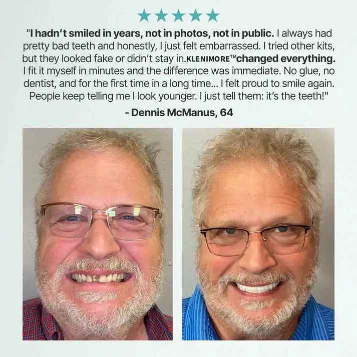 Medical Full Denture with Strong Suction - Image 12