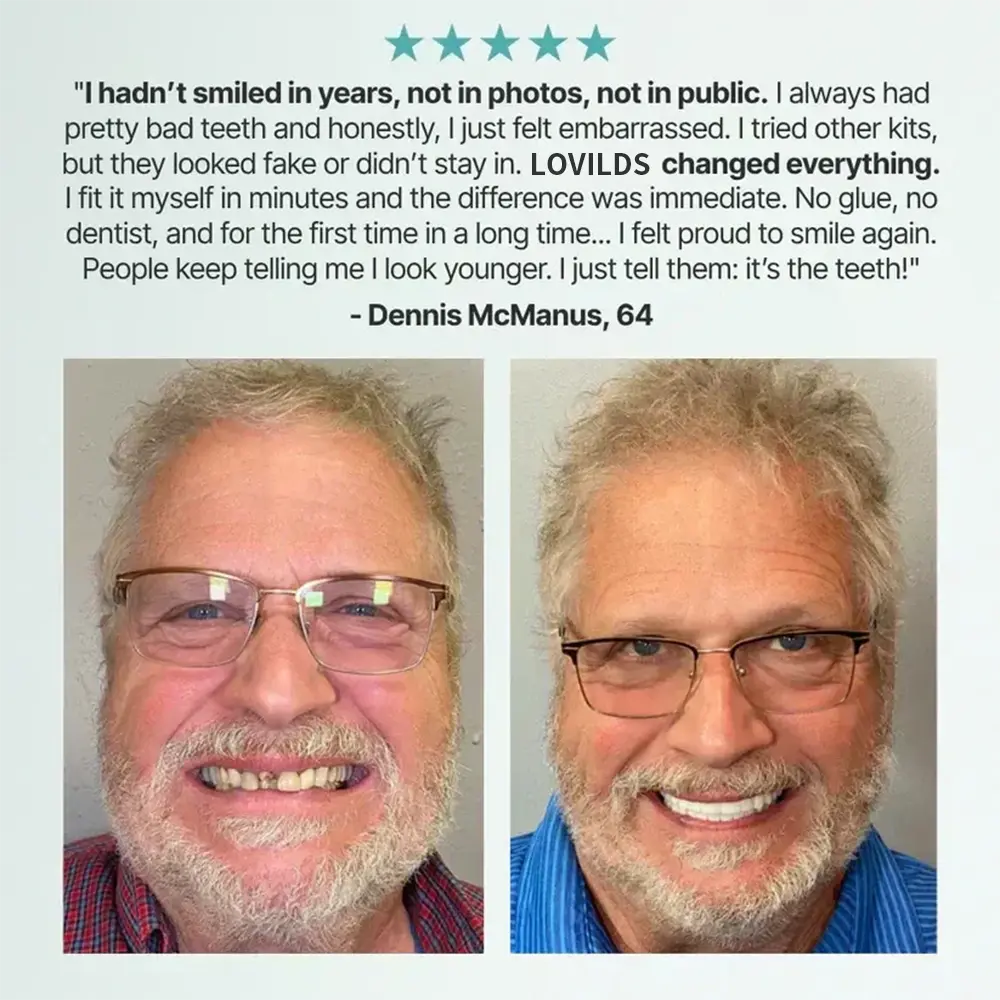 Medical Full Denture with Strong Suctiond - Image 12