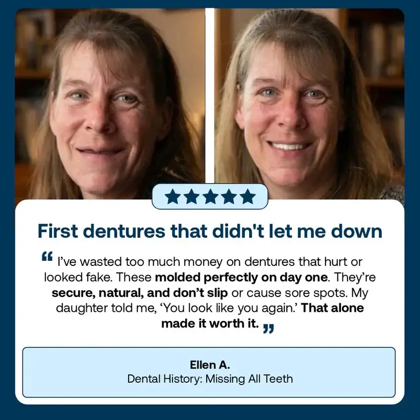 Custom-Fit Dentures - Image 6