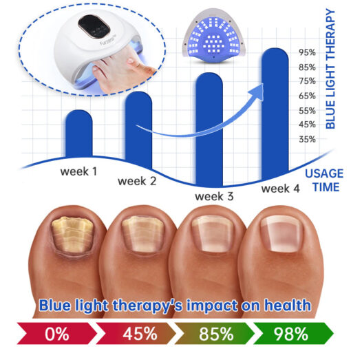 Advanced PureNail Fungus Laser Device - Image 4