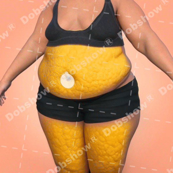 MORINGA BERBERINE & NDA+NMN Advanced Nano Microneedle Patch - Image 3