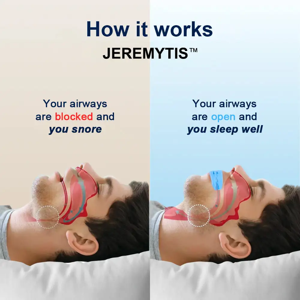 Professional intelligent anti-snoring device - Image 2