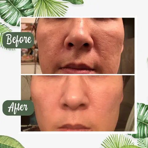100% Natural Green Tea Deep Cleanse Mask - Image 4
