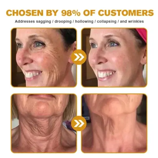 Bee Venom Wrinkle Removal Cream - Image 4