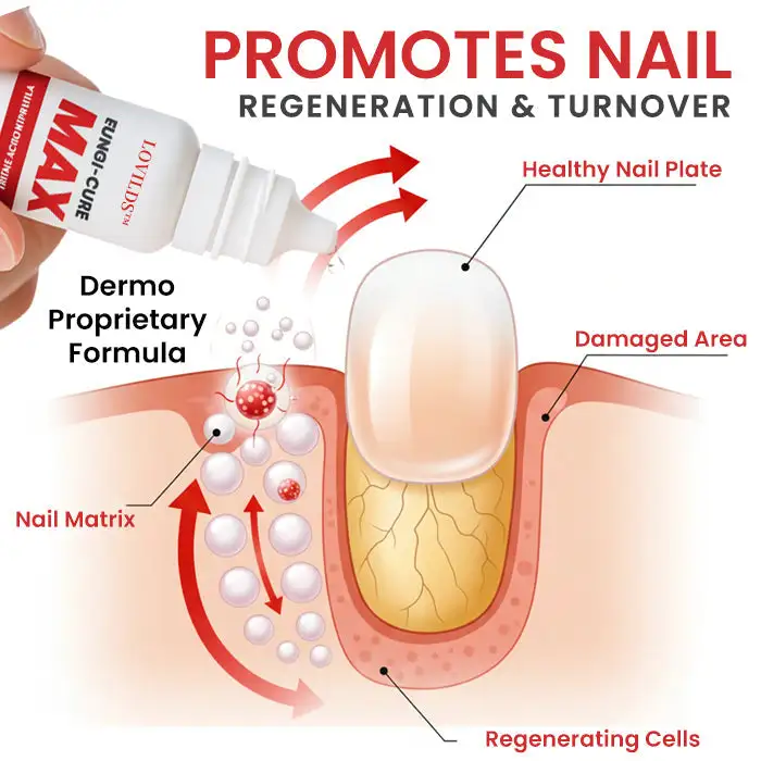 Fungi-Cure Max Fast-Acting Relief for Fungal Nail Infections - Image 3