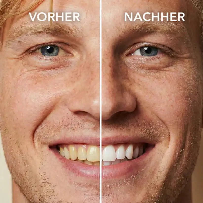 Tooth Polish - Instant Whitening for a Sparkling Smile - Image 2