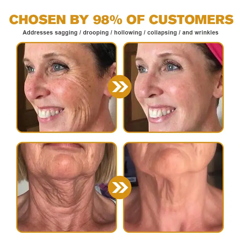 Botox Bee Venom Wrinkle Removal Cream - Image 5