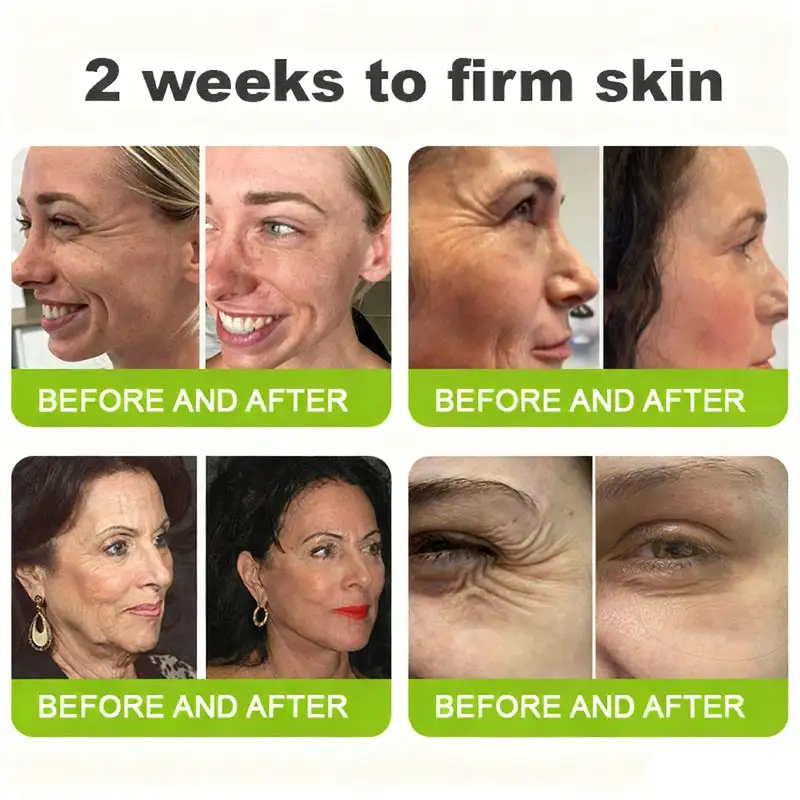 Botox Vitamin A Retinol Anti-Wrinkle Firming and Lifting Cream - Image 3