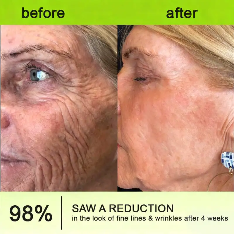 👏🌿 Made in the USA direct shipping Botox Vitamin A Retinol Anti-Wrinkle Firming and Lifting Cream - Image 17