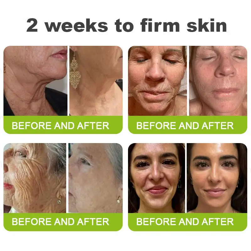 👏🌿 Made in the USA direct shipping Botox Vitamin A Retinol Anti-Wrinkle Firming and Lifting Cream - Image 4
