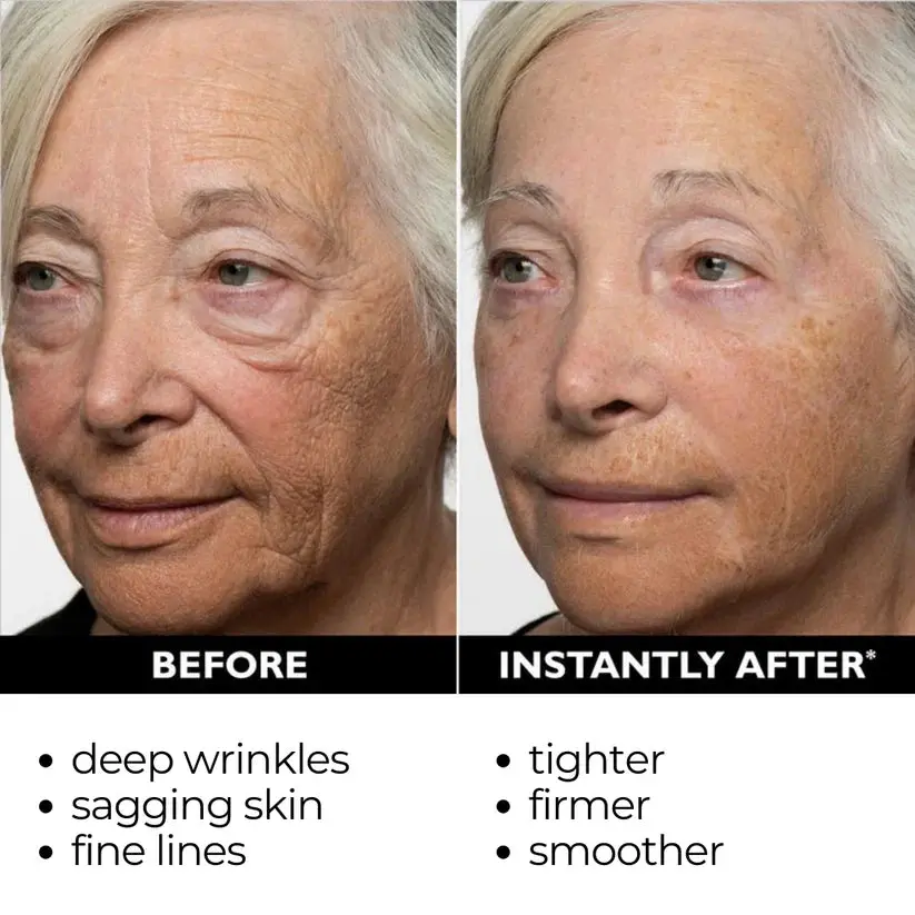 Lift & Firm Instant Skin Tightener - Image 3