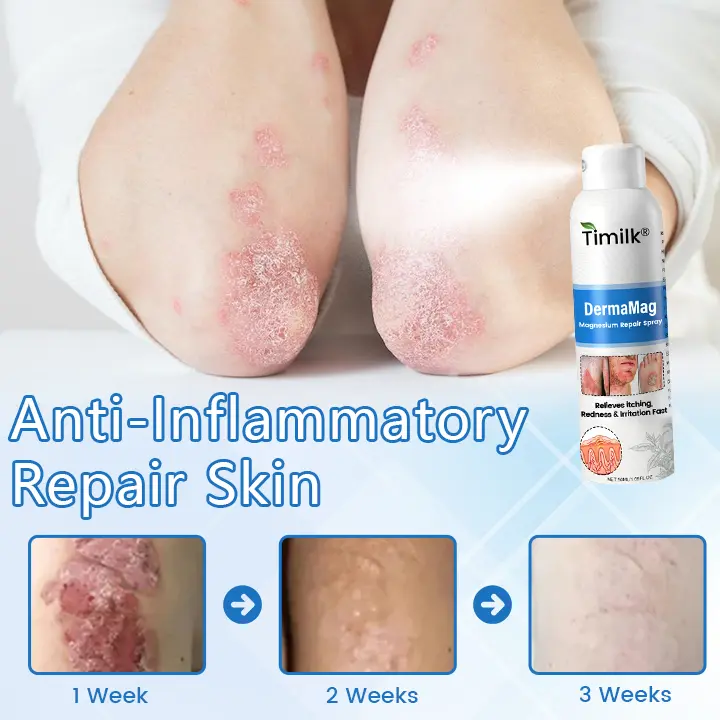DermaMag Magnesium Repair Spray - Image 7