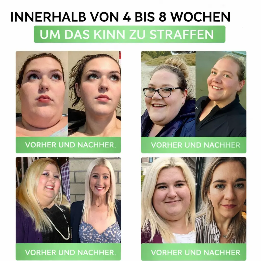 Alcuras Moringa × Berberin × AMPK 8-fach Slimming & Stoffwechsel-Nano-Mikronadel-Patch - Image 3