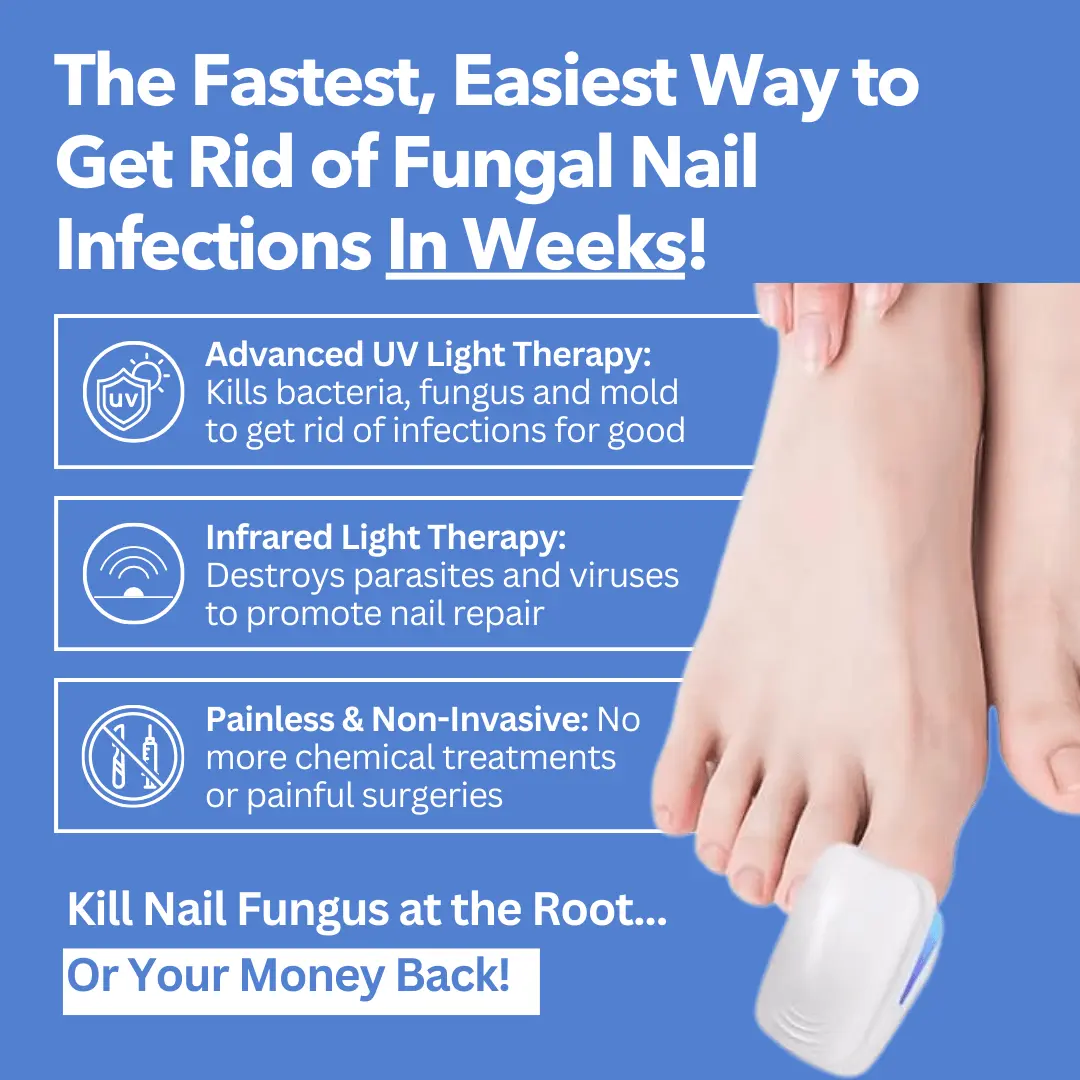 - Nail Fungus Laser Device - Image 4