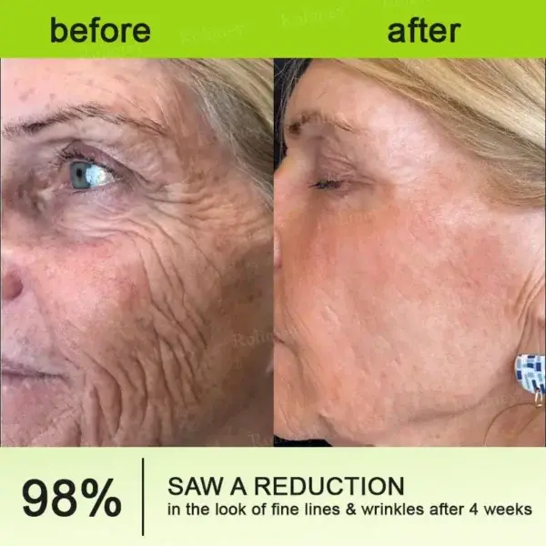 Botox & Vita-A Retinol Shot Tightening and Wrinkle-Reducing Cream - Image 11