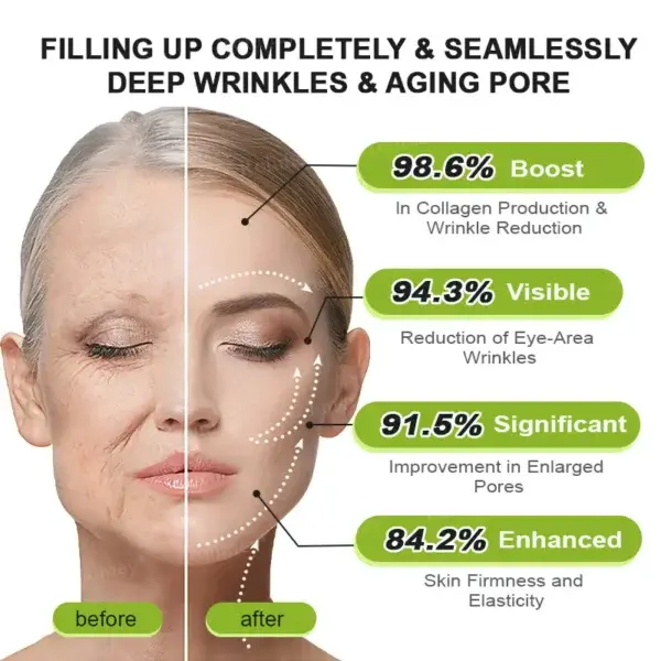 Botox & Vita-A Retinol Shot - Image 4