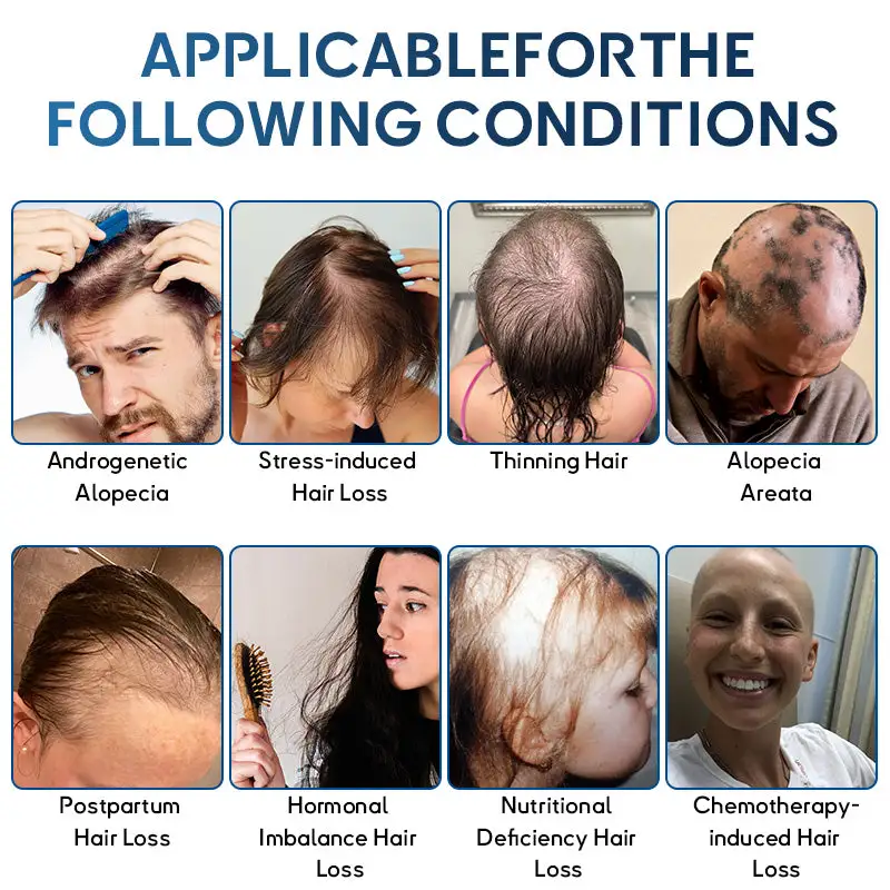 STEM Cell Hair Cycle Roller - Image 6