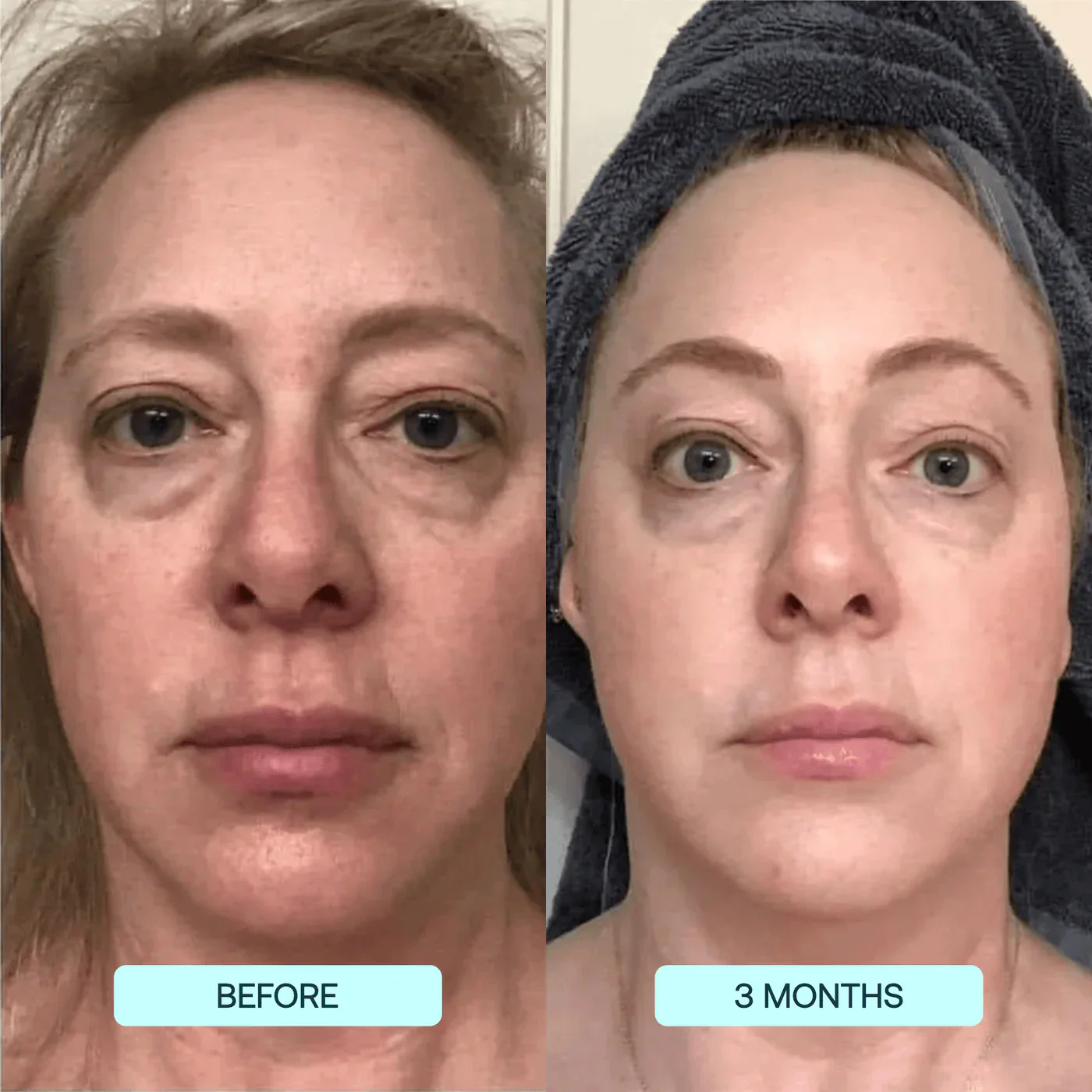 Hyaluronic Acid Niacinamide Hydrating Mask - Image 6
