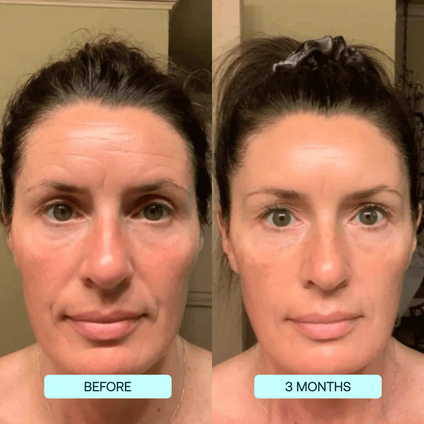 Hyaluronic Acid Niacinamide Hydrating Mask - Image 7