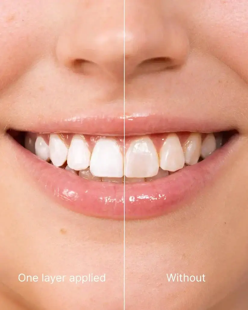 Smileasegot Tooth Polisher – Instantly Brighter Smile - Image 4