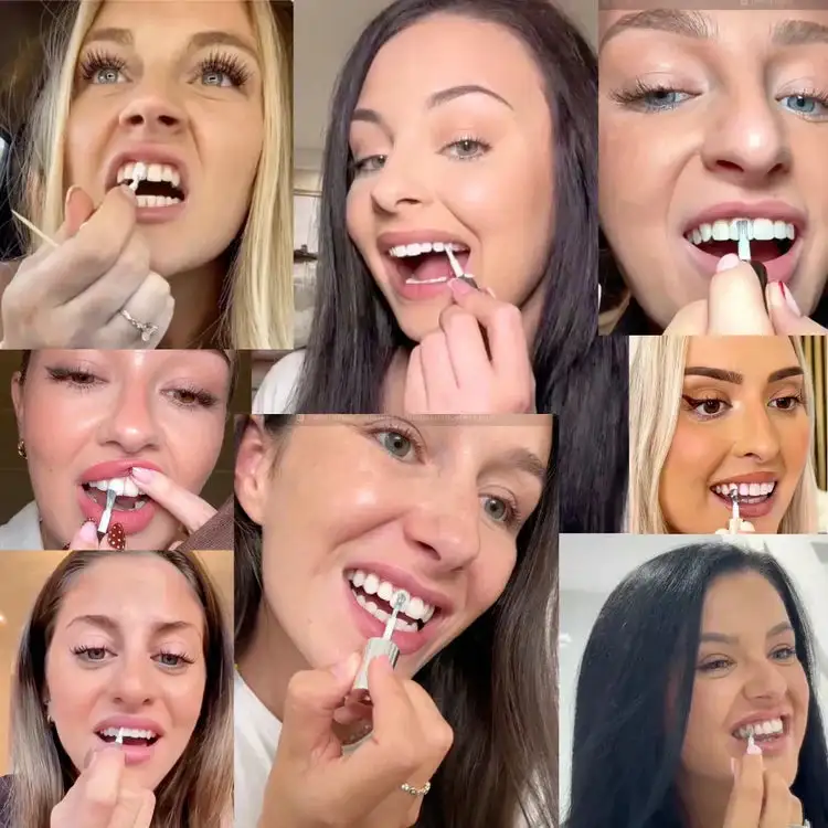 Tooth Polish - Instant Clean Smile - Image 4