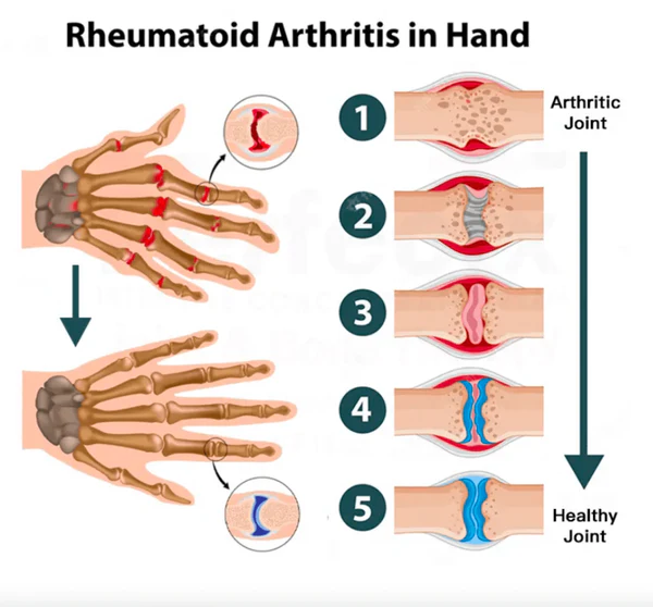 Joint and Bone Therapy Gel - Image 4