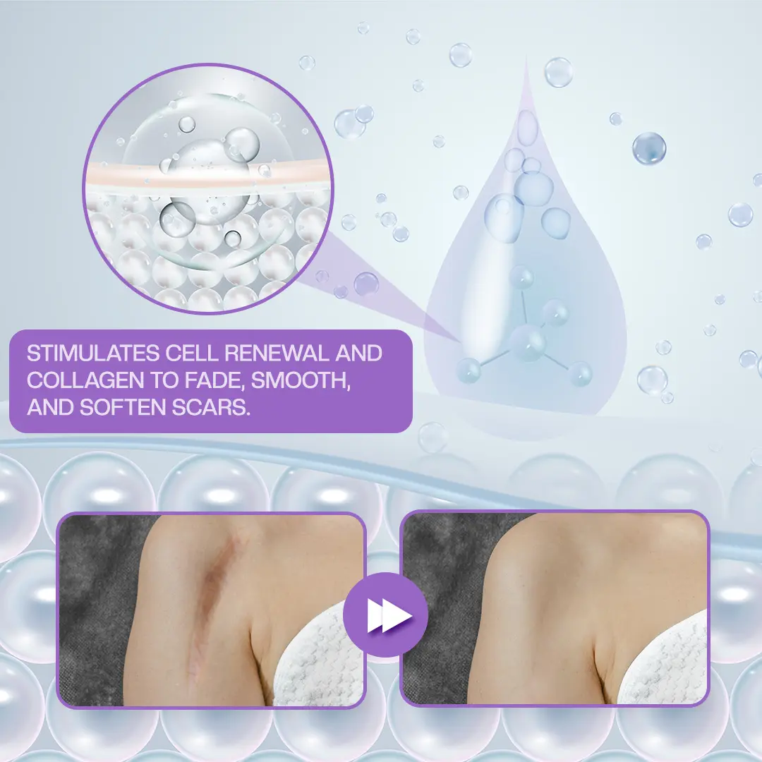 RevivaDerma Face & Body Scar Gel - Image 12