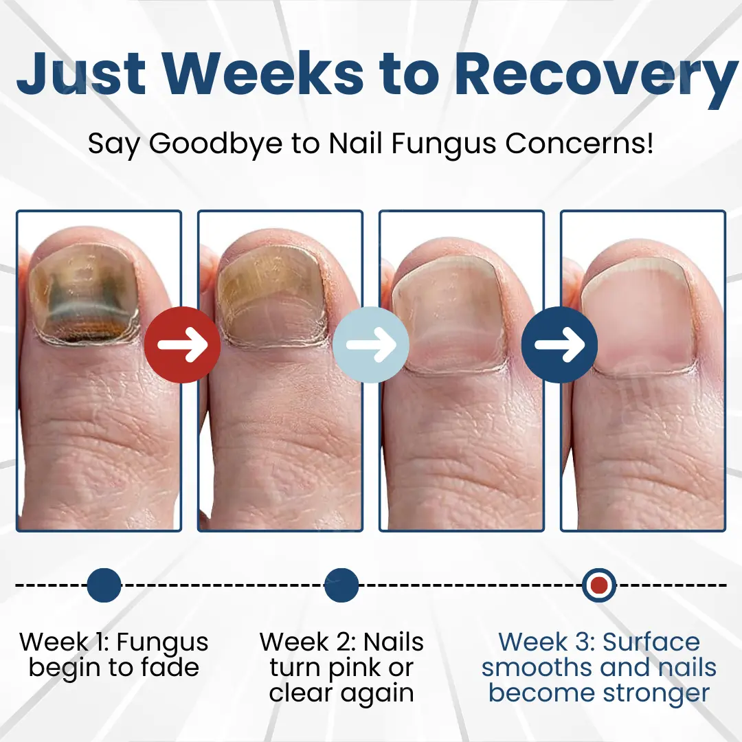 Bio-Active Deep Penetration System for Nail Fungus - Image 2