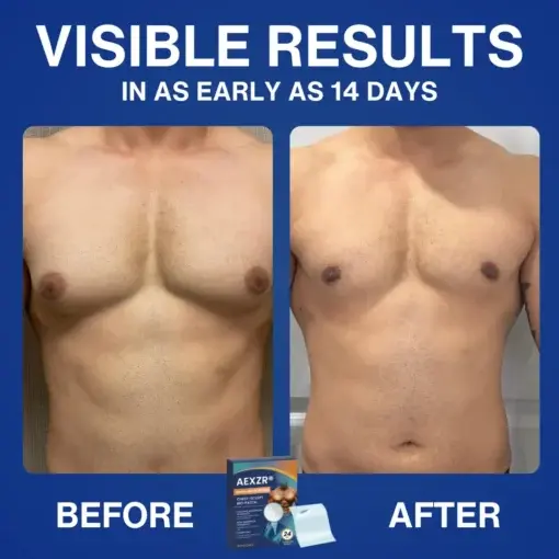 Nano-Microneedle Chest-Sculpt Bio-Patch (๐๐ฎ๐ฌ๐ญ ๐จ๐ง๐๐ ๐ ๐๐๐ฒ, ๐ฏ๐ข๐ฌ๐ข๐๐ฅ๐ ๐๐ก๐๐ง๐ ๐๐ฌ ๐ข๐ง ๐ ๐ซ๐๐ฒ๐ฌ ๐
๐จ๐ซ ๐๐ฒ๐ง๐๐๐จ๐ฆ๐๐ฌ๐ญ๐ข๐, ๐๐ฑ๐๐๐ฌ๐ฌ ๐๐ก๐๐ฌ๐ญ ๐
๐๐ญ, ๐๐๐ ๐ ๐ข๐ง๐ ๐๐ค๐ข๐ง, ๐๐๐๐๐ ๐ฆ๐๐๐ก, ๐๐ง๐ ๐ฆ๐จ๐ซ๐ - Image 4
