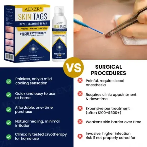 Skin Tag Cryo Treatment Spray Precision Cryo-Tech Freezes Away Skin Tags Warts in Seconds No Blades, No Pain - Image 6