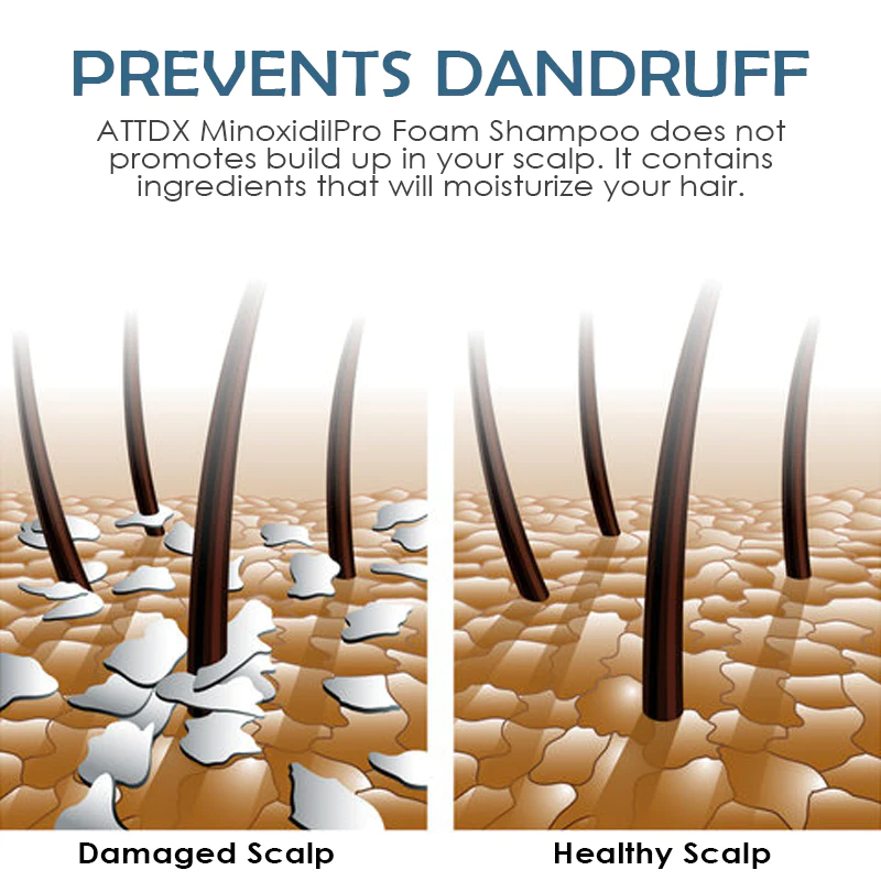 ATTDX MinoxidilPro HairRegrowth FoamShampoo - Image 3