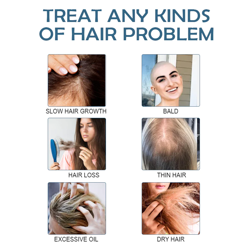 ATTDX MinoxidilPro HairRegrowth FoamShampoo - Image 6