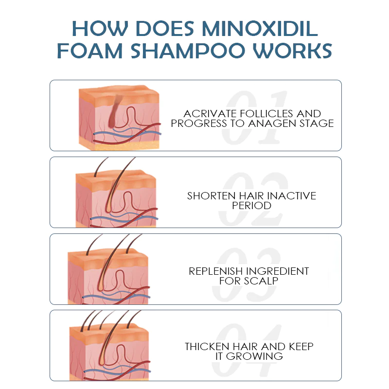 ATTDX MinoxidilPro HairRegrowth FoamShampoo - Image 7