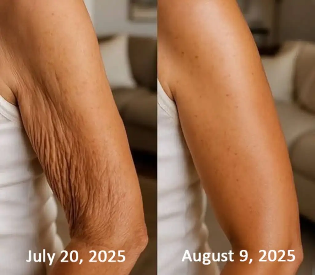 Botox & Retinol Shot - Eraser for deep wrinkles - Image 20