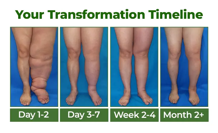 Professional Leg Circulation Cream - Image 3
