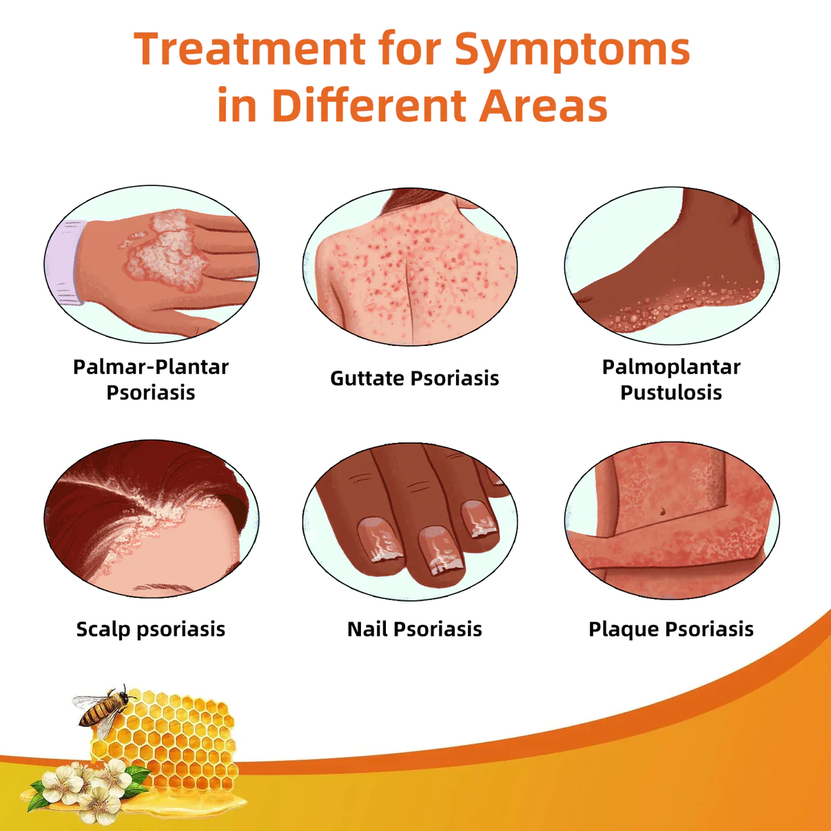 Cvreoz Bee Venom Psoriasis Treatment Cream - Image 4