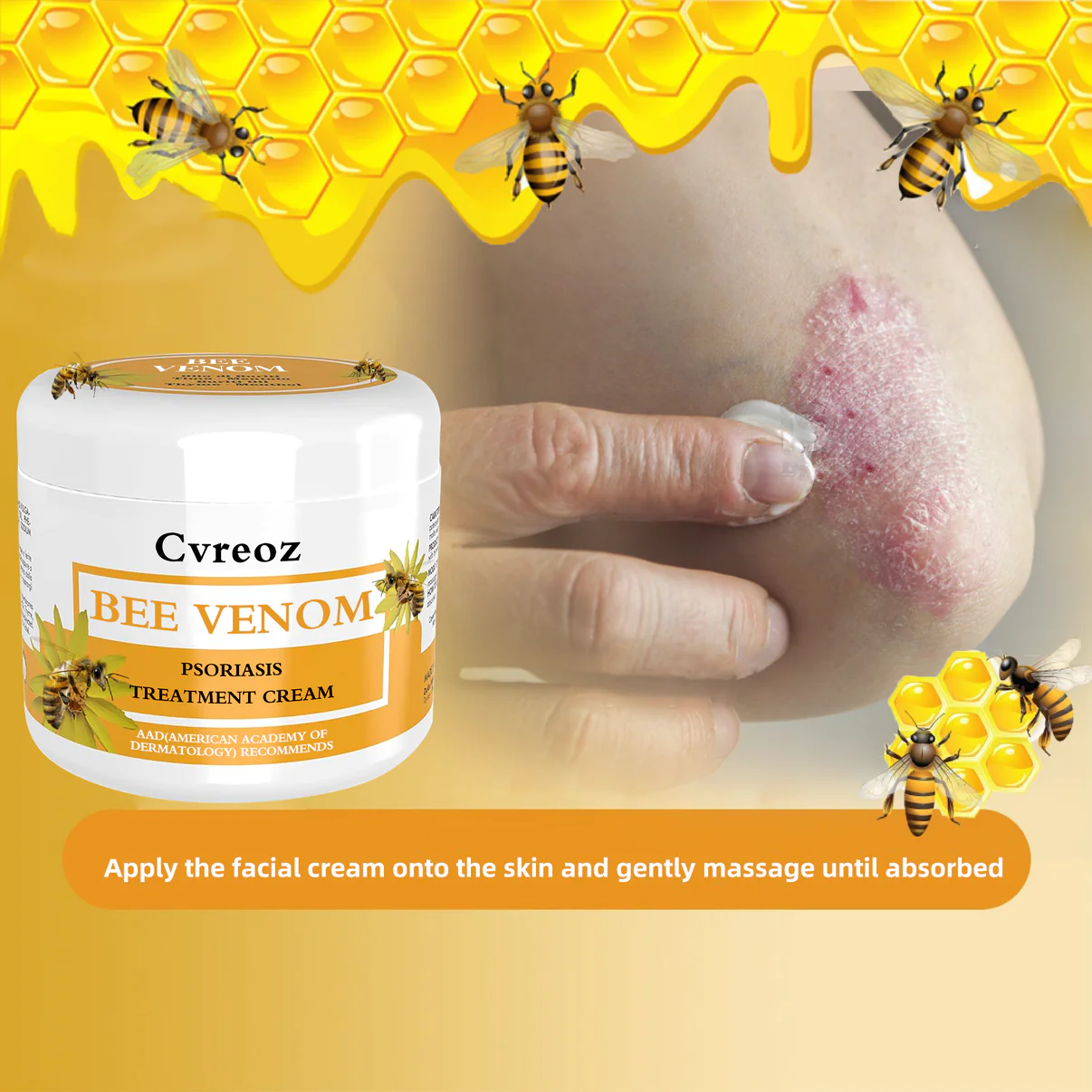 Cvreoz Bee Venom Psoriasis Treatment Cream - Image 6