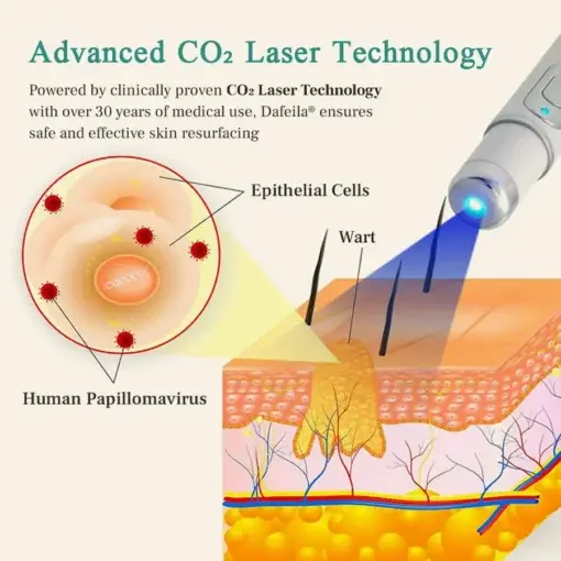 LumeSkin Mole and Wart Instant Removal Laser Pen - Image 5