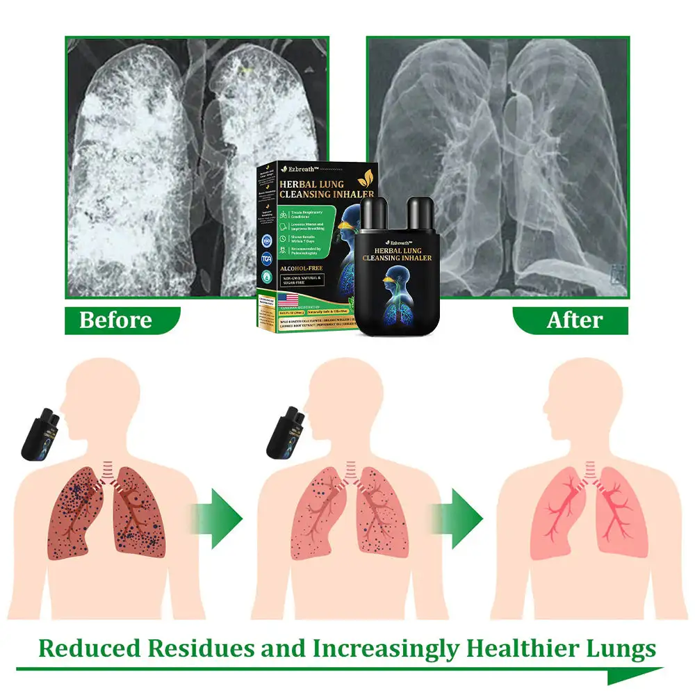 Herbal Lung Cleansing Inhaler - Image 6