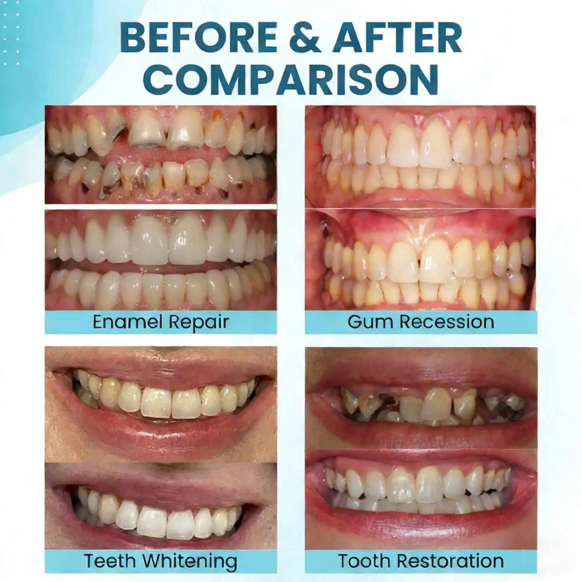 Smilewell Bee Venom Oral Care Powder - Image 2