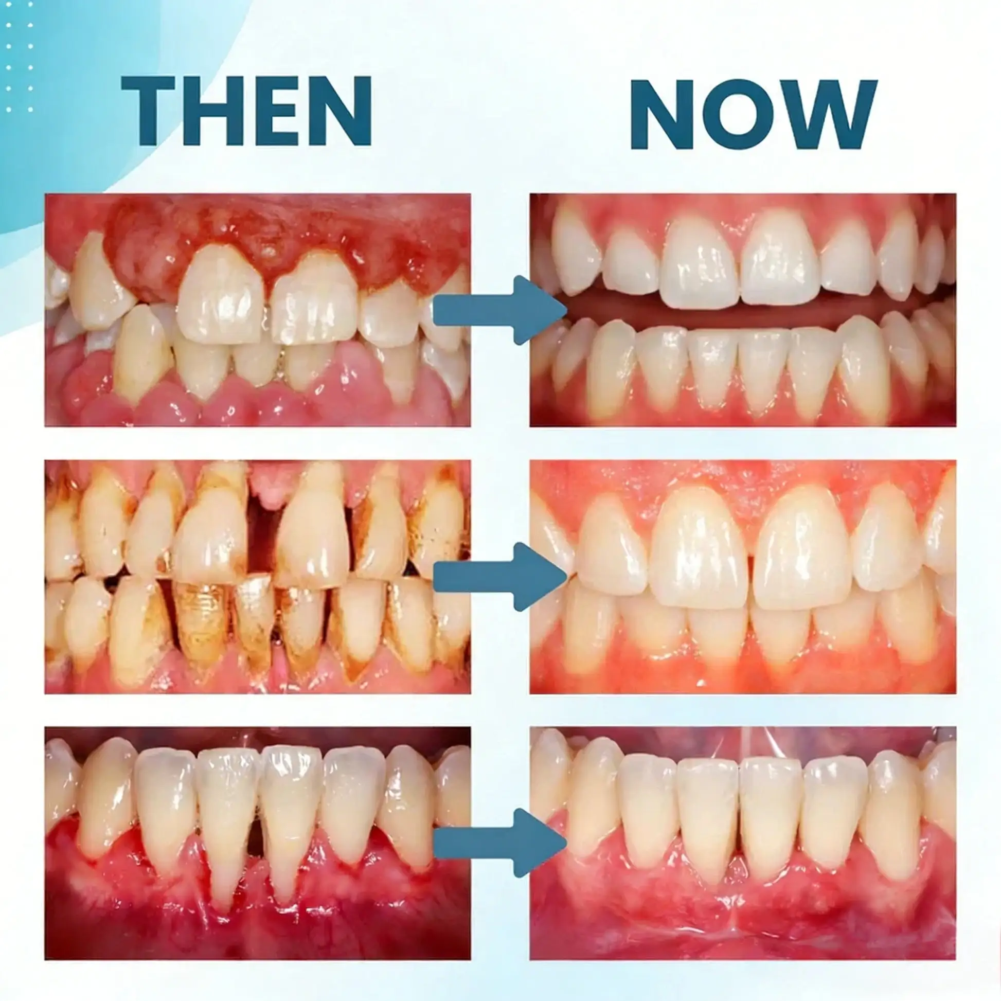Smilewell Bee Venom Oral Care Powder - Image 4