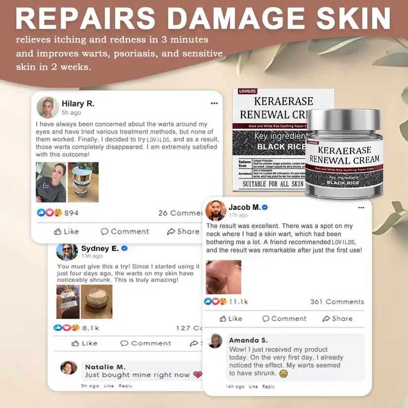 Flash Sale: KeraErase Dual-Action Renewal Cream - Image 4