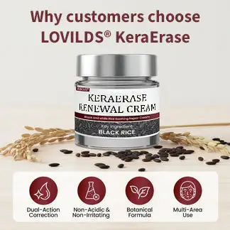 Flash Sale: KeraErase Dual-Action Renewal Cream - Image 5
