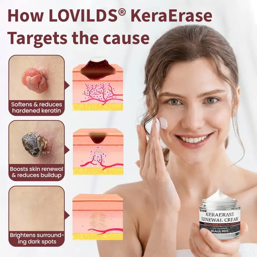 Flash Sale: KeraErase Dual-Action Renewal Cream - Image 6