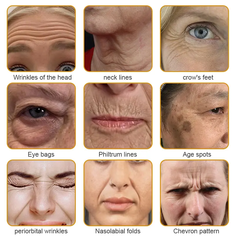 Botox Bee Venom Wrinkle Removal Cream-Last Day Promotion 80% OFF - Image 3