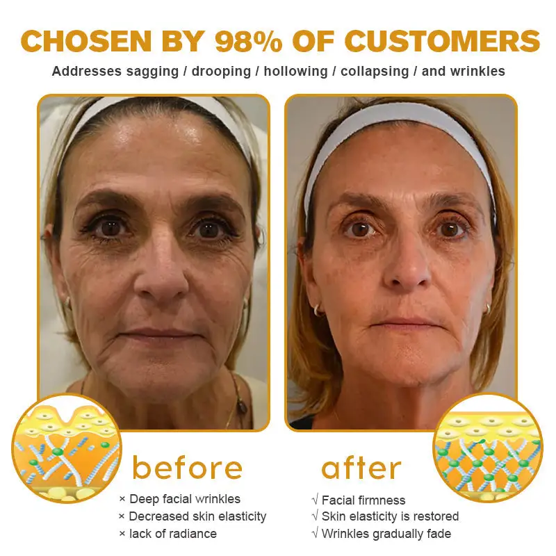 Botox Bee Venom Wrinkle Removal Cream-Last Day Promotion 80% OFF - Image 7