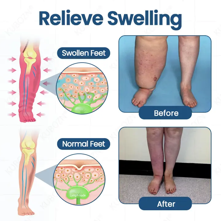 Roll-On Cream for Lymphatic Drainage & Swelling Relief - Image 3
