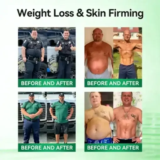 10-IN-1,Moringa-Slimming and Fat-Burning Hot Cream - Image 2