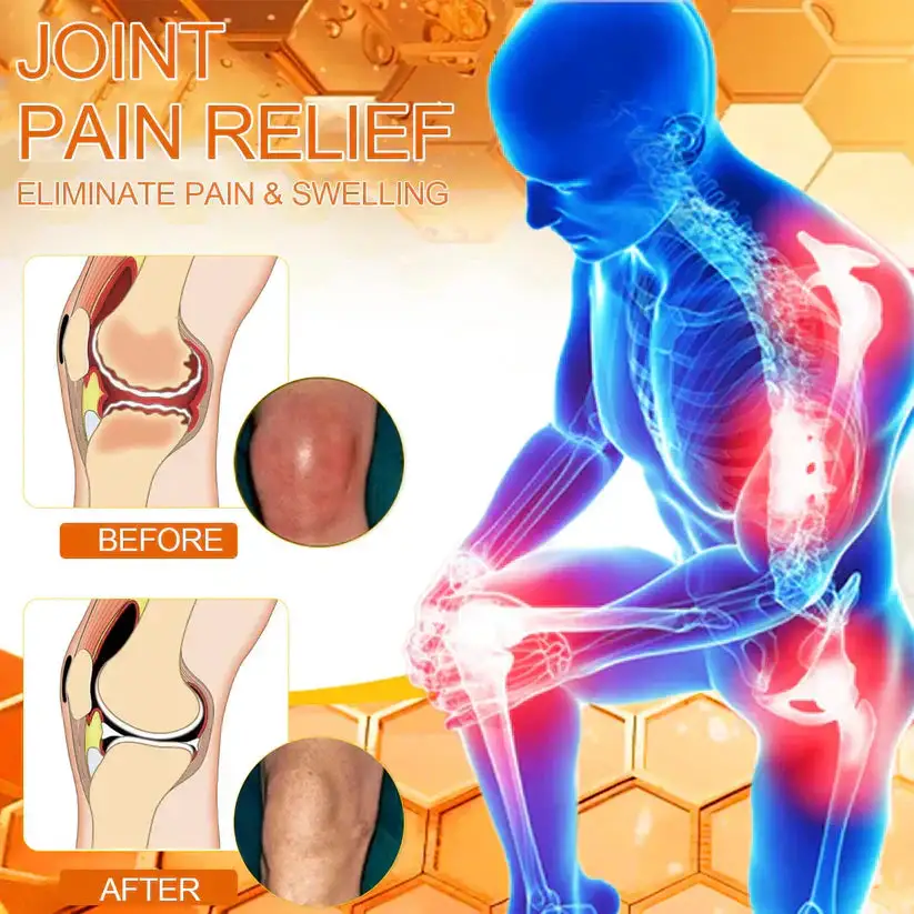 LOVILDS Bee poison Pain ArthritisTherapy Cream - Image 7